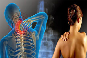 Como funciona o tratamento da Esclerose Múltipla no plano de saúde?